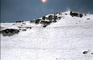 C0000476147